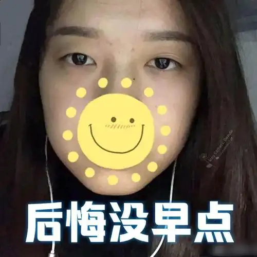 可我明明只割了一个双眼皮_双眼皮_开眼角_双眼皮手术_女朋友_内双