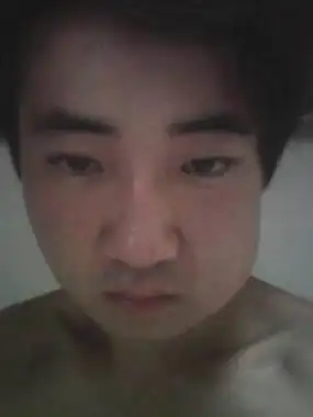 我牙龈发炎了.肿了,睡了一觉,肿的更大了.这是什么问题.