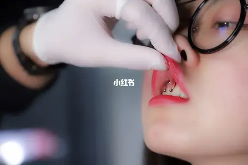 微笑钉北京穿刺三里屯穿孔人体穿孔