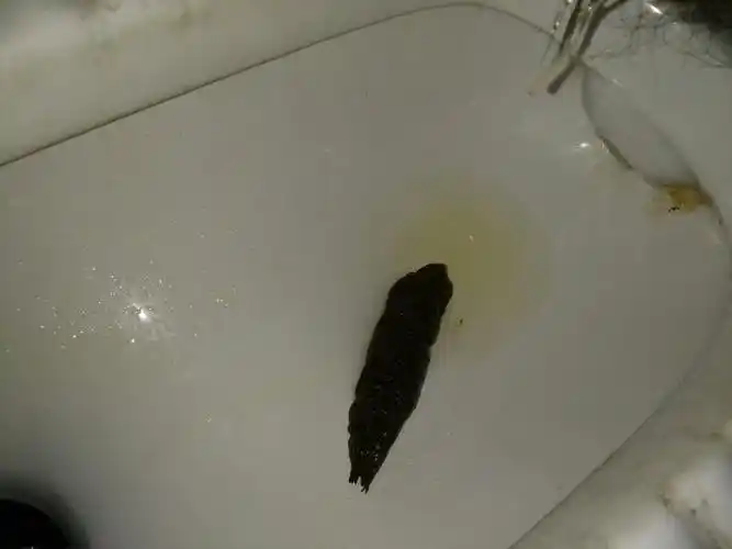 天天都是拉这样的大便这是什么情况呢?与什么有关系的呢?