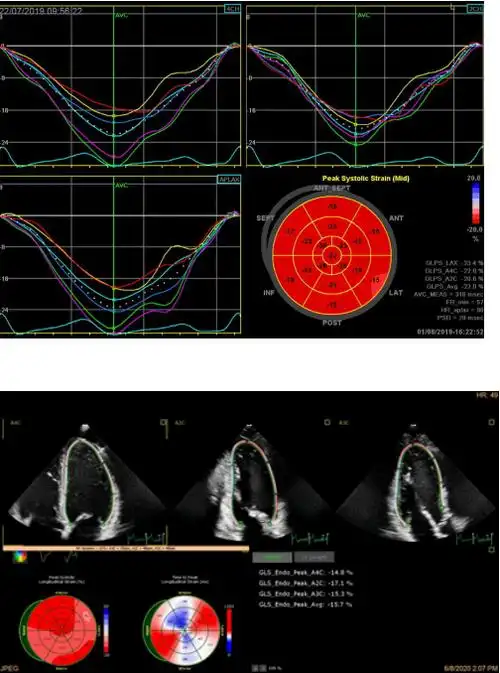 江勇: 【2020学术荟萃】人工智能在超声心动图的应用及进展 · 365