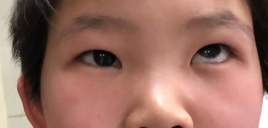 运城市眼科医院斜视与小儿眼科向大家拜年啦!