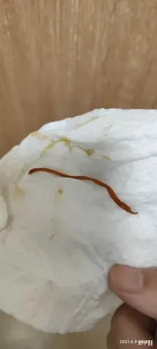 今天上厕所拉了好大一条蛔虫出来怎么办