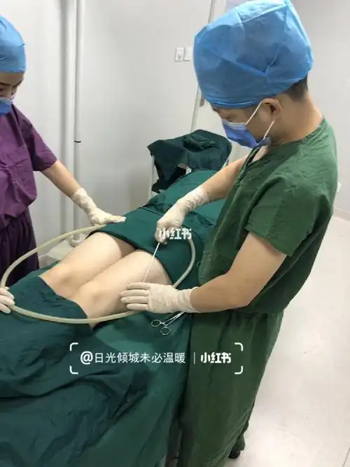 生孩子的痛都经历了,难道我还怕吸脂吗?