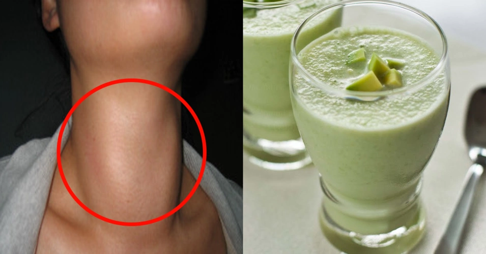 掉发,易胖,大脖子?全是「激素失衡」惹的祸!