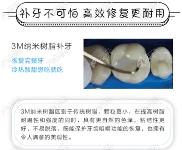 补牙多少钱一颗2022价格表公示,来看补牙花了2800正常吗?