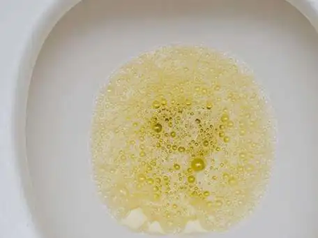 如果女性朋友在小便没有及时到用卫生纸擦拭,那么很有可能就会出现