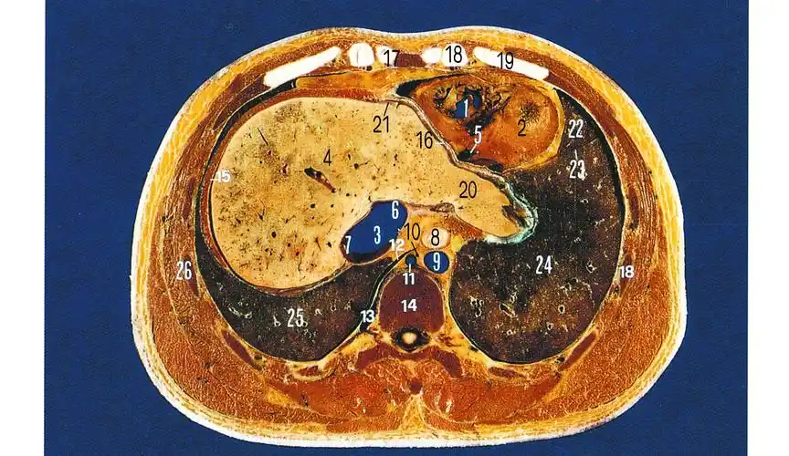 第十八节 第二肝门上份层面-胸心外科解剖-医学