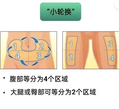 还有小轮换:上臂外侧,腹部臀部外上侧,大腿外侧胰岛素注射的常用部位