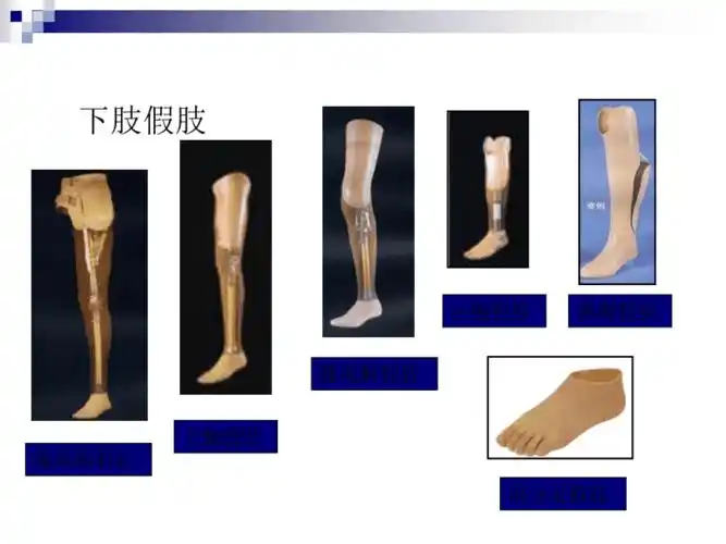 第二章假肢技术第二节下肢假肢资料pptppt