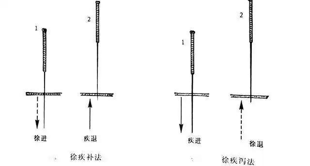 补法:针刺入浅层得气后,随之将针身徐徐推入到穴位深层,急速退针至皮