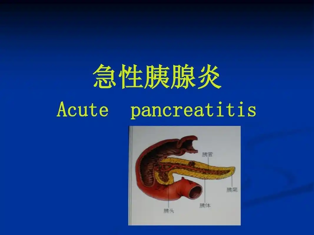 急性胰腺炎ppt