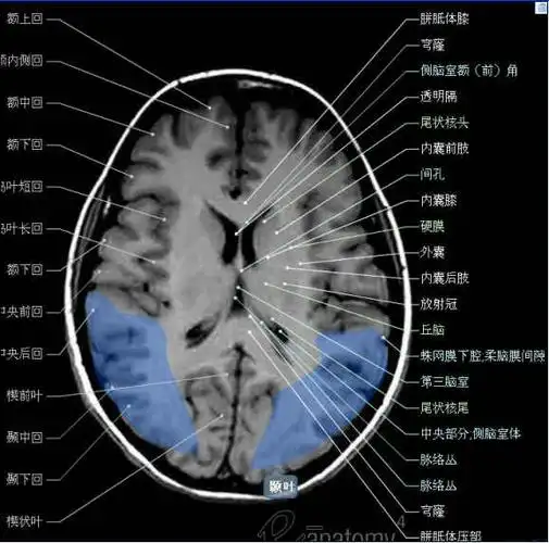 神经解剖| 头颅mr轴位解剖图_手机搜狐网