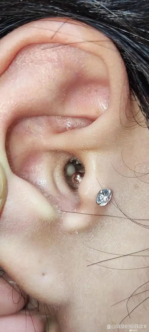 耳朵里长似珍珠的球球,让人心中慌乱.