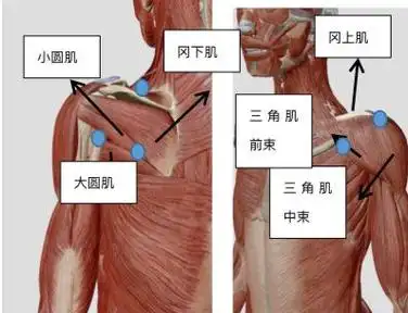 刺至小圆肌浅筋膜,引起肌肉抽动,退针至天部,针刺至三角肌后束下,抽拉