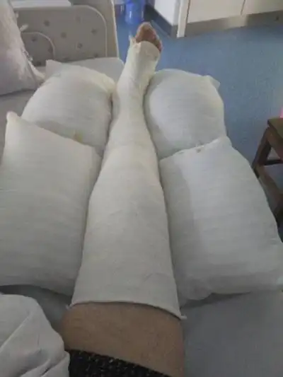 男生腿部受伤包扎图片6