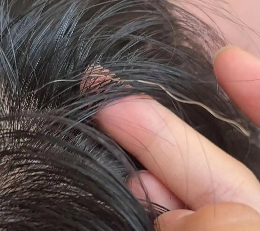 白色发王拔了会怎么样