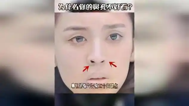 为什么你的鼻子不好看挖鼻孔会让鼻孔变大吗