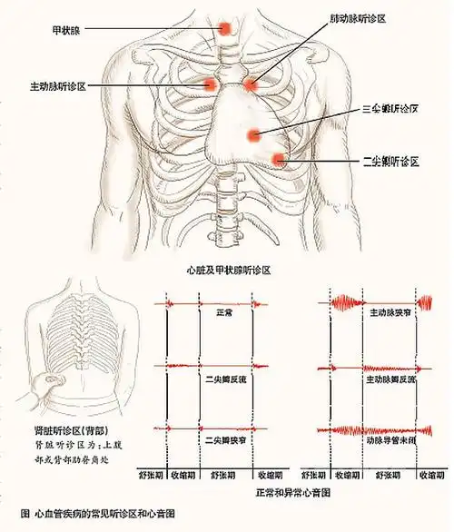 室间隔缺损            室缺杂音有特点,胸骨左缘三四间.