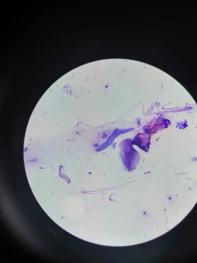 显微镜下的世界 显微镜下的微观世界-"小孢子菌"这是一种 - 抖音