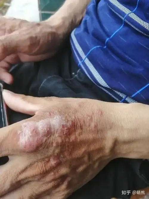 奇怪的手 - 知乎