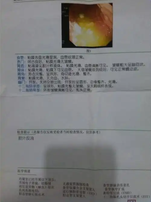 问:这是我的一张胃镜报告单,请问这个能不能算正常?