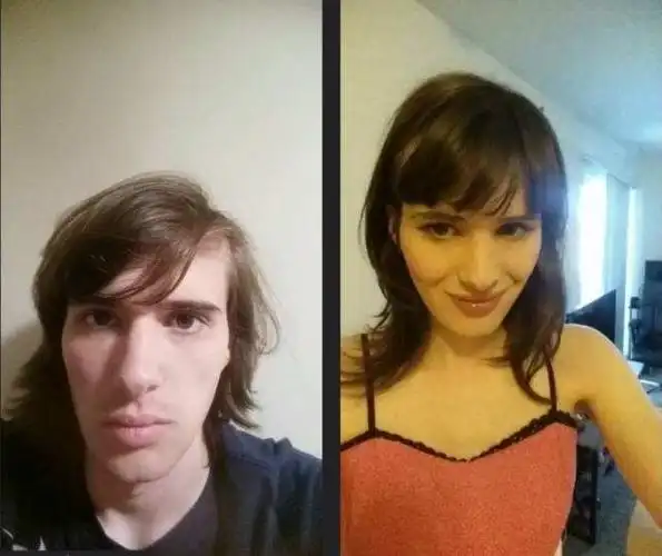 他用照片记录自己从男生变为女生的变性过程,变化很大.