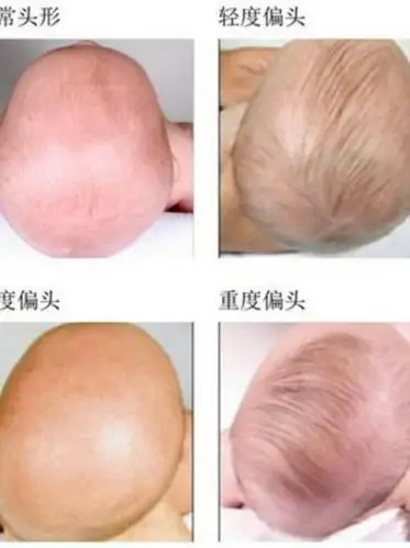 开始新生活也不错,曾经的陈德容可以说是女神一般的存在,大眼睛小嘴巴