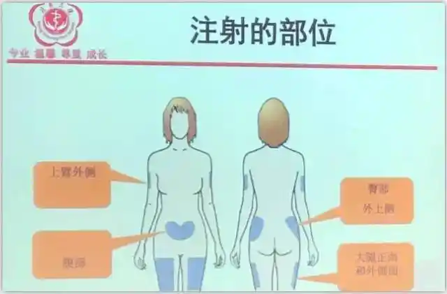腹部,臀部外上侧,大腿正面和外侧面● 大轮换(3)皮下注射低分子肝素
