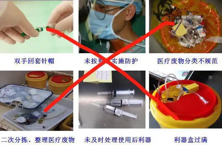 预防针刺伤的防护措施(预防针刺伤的防护措施是什么)