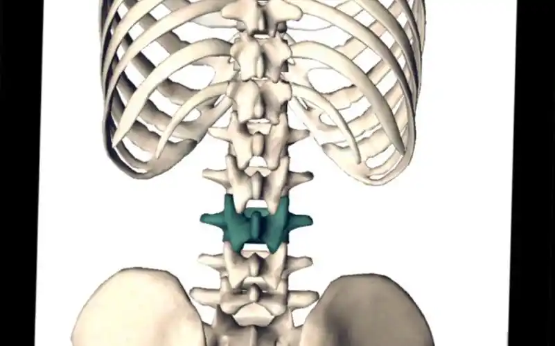 第三腰椎横突综合征是腰痛或者腰腿疼痛病人常见的一种疾病,临床表现