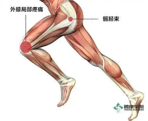 髂胫束摩擦综合征的分析与治疗(it band综合征)