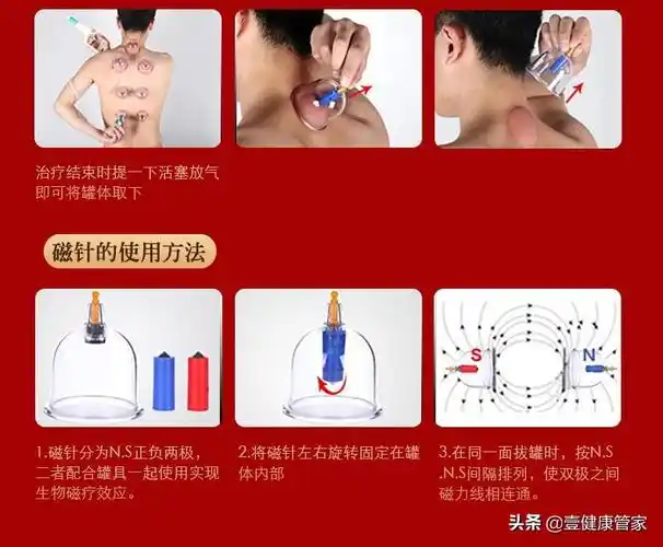 腿部拔罐去湿气的正确位置图