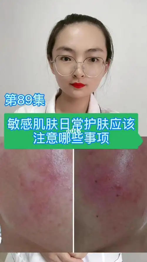 敏感肌肤日常护肤应该注意哪些事项