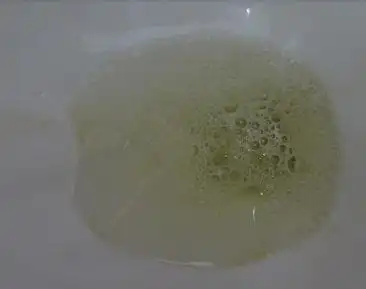 正常人因为尿道的分泌物多,排尿的高低位置,尿急,冲劲大,喝水少,出汗