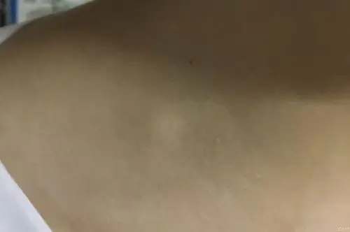 发现右锁骨上窝包块2天原已完善相关辅助检查