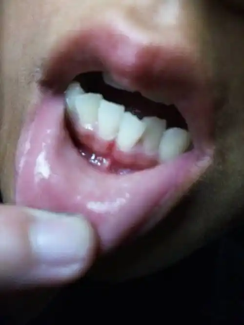 需要去医院看一下吗?求专业人士解答!急急急!