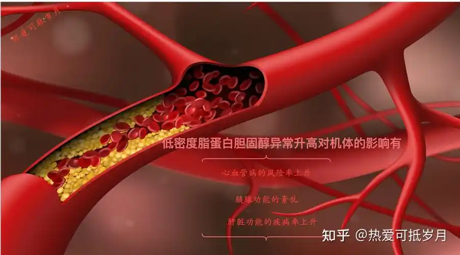 低密度脂蛋白胆固醇异常升高对机体的影响有