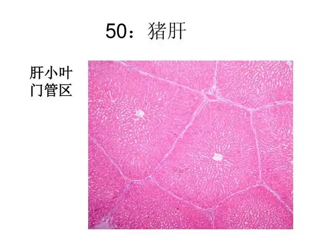 50:猪肝 肝小叶 门管区