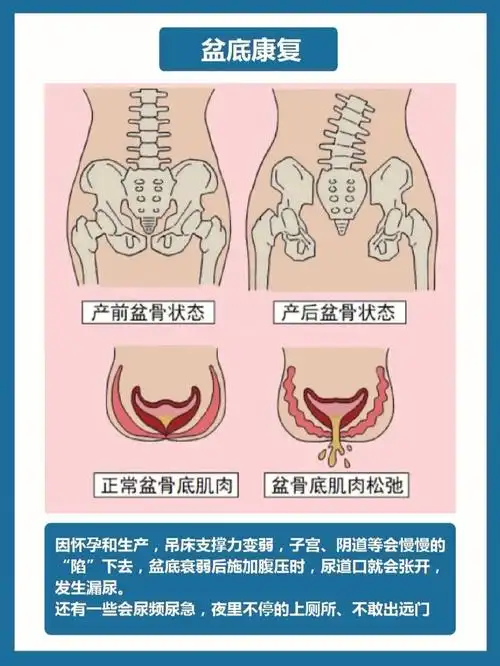 肌修复】(顺产剖腹产都有必要做)简单的来说,这个部位是关乎x生活的