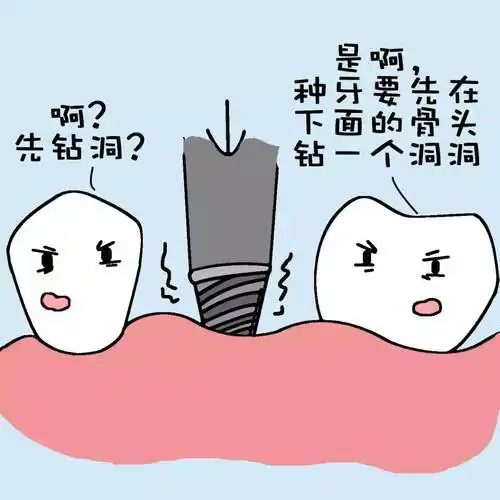 谈谈种牙那些事(二)