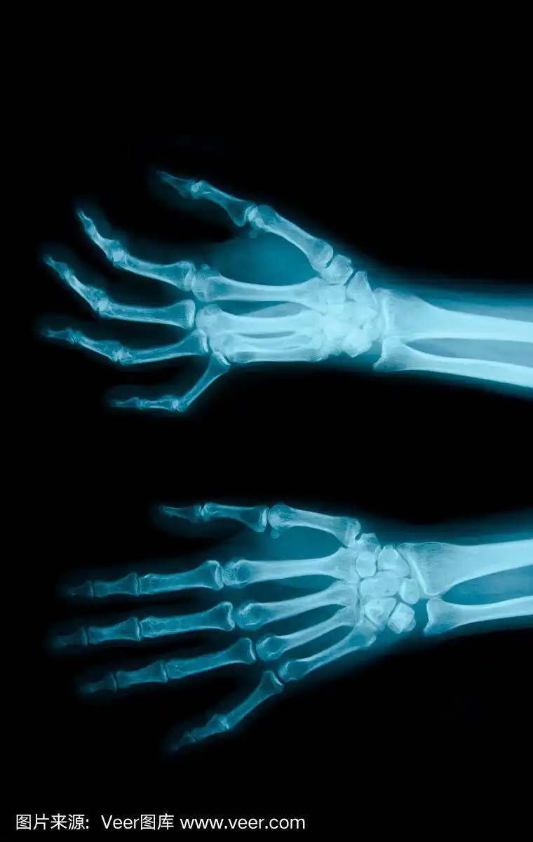 x光片显示骨骼