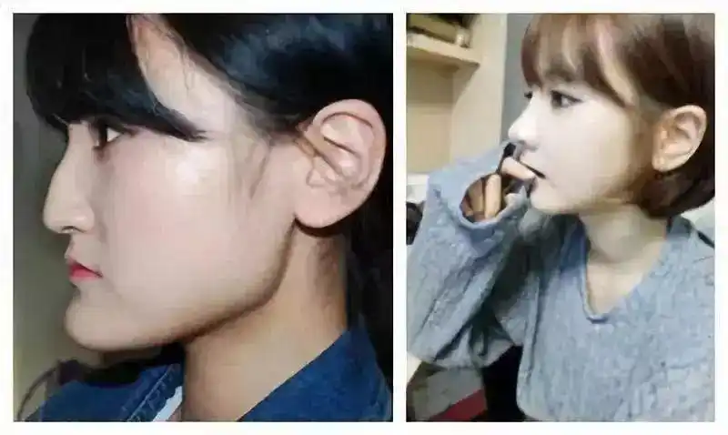 "地包天"和"天包地"面相,命运有什么不同