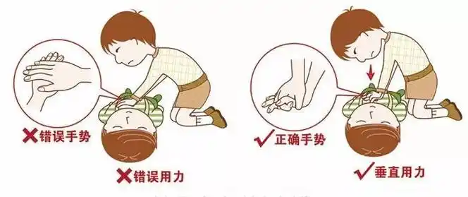 心肺复苏的这些步骤都来温习一下