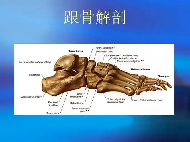 跟骨骨折的治疗策略ppt