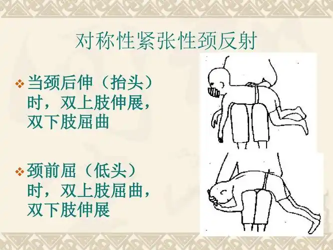 对称性紧张性颈反射   当颈后伸(抬头) 时,双上肢伸展, 双下肢屈曲