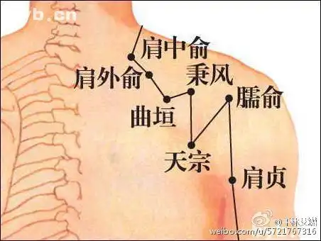 艾灸治疗肩周炎