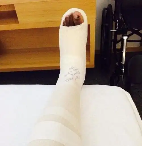 奥纳齐自拍受伤的脚部