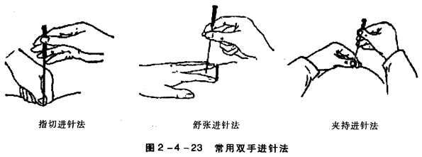 [问答题,简答题] 请具体演示"舒张进针法".