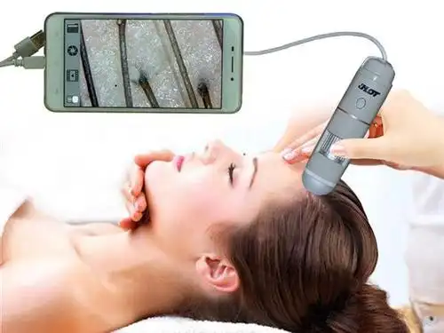 hot 皮肤毛发测试仪 头皮毛囊检测仪 usb接口200万像素5-200x